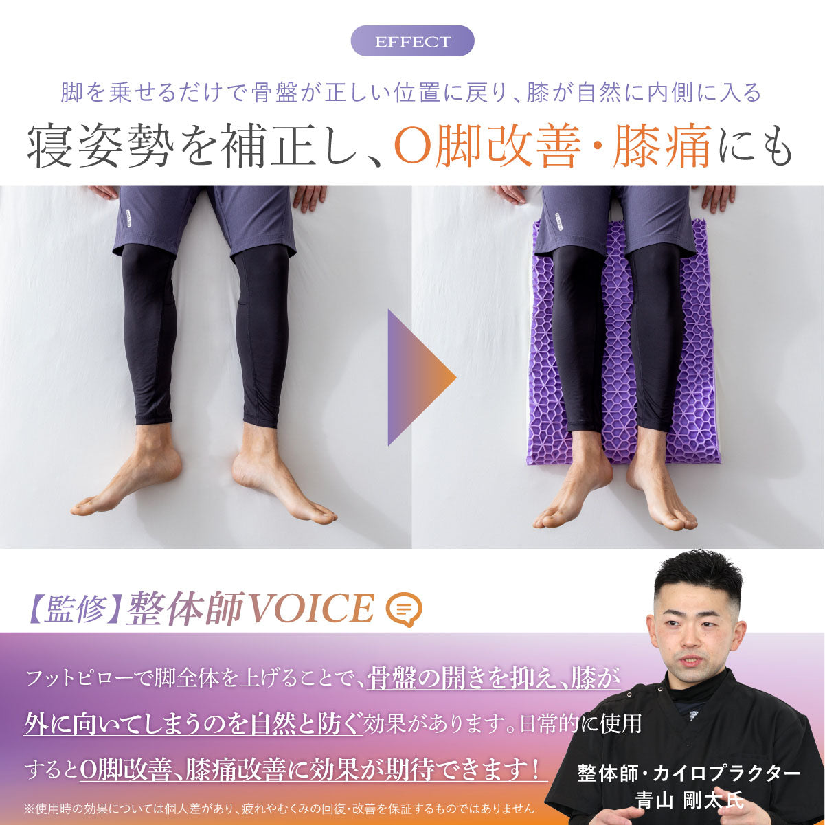 寝姿勢を補正し、O脚改善・膝痛にも